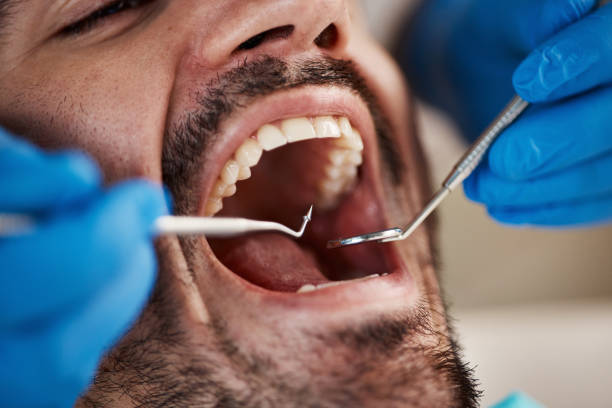 Best Emergency Tooth Extraction in Lisbon, ME